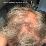 Hey Joe Power Hair Pack Champú + Loción Anticaida - Imagen 6