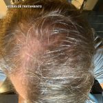 Hey Joe Power Hair Pack Champú + Loción Anticaida - Imagen 7